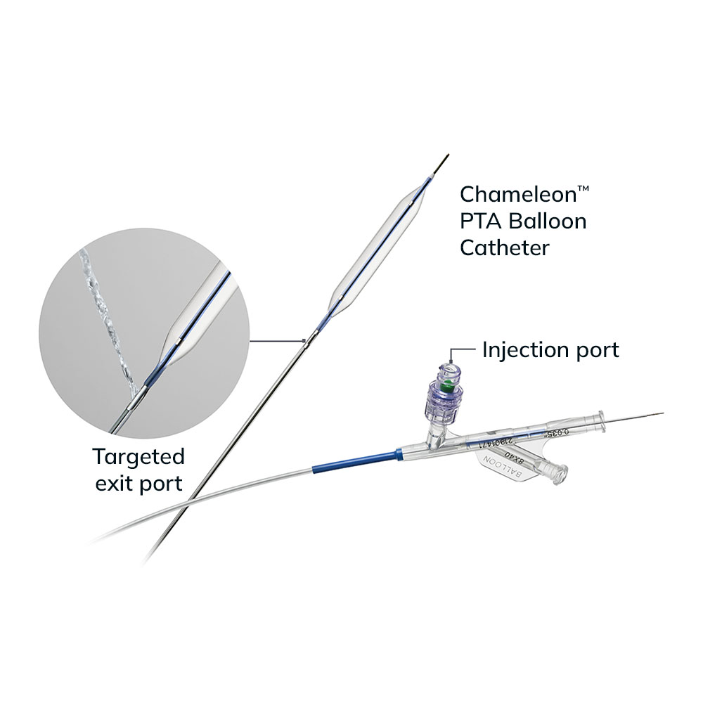 chameleon-PTA-balloon-features-1000x1000-2