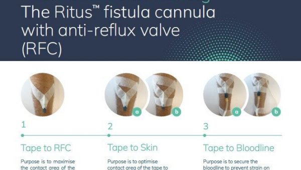 EMEA-RC-2300038_AFC-securement-guide-600x338