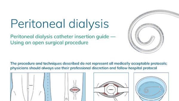 peritoneal-dialysis-open-surgical-insertion-mozarc-guide-thumbnail