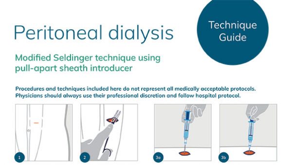 peritoneal-dialysis-seldinger-technique-mozarc-guide-thumbnail